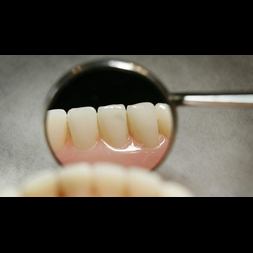 value good teeth
